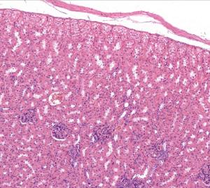 Simple Squamous Epithelium